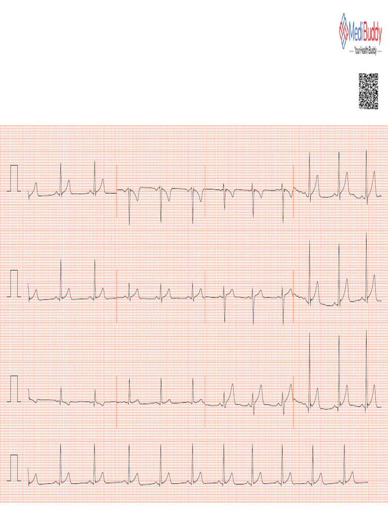 Mda 027o5mb976x0pk0 V76X0PL6 | PDF | Electrocardiography ...