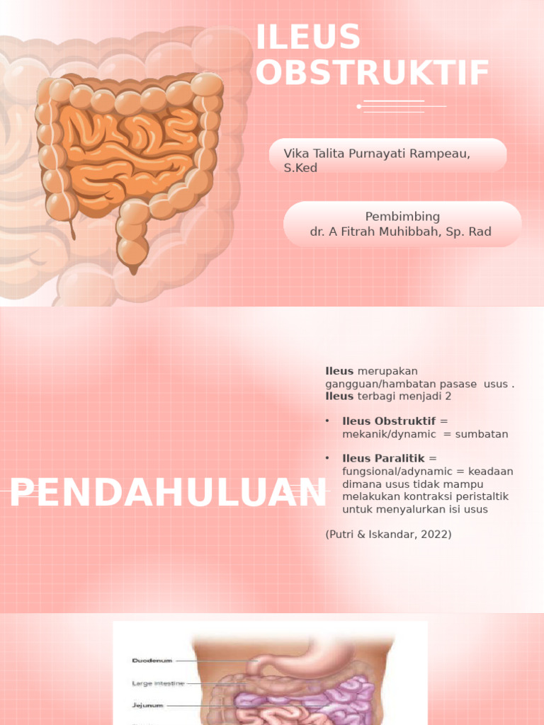 Vika Talita - Refarat Ileus Obstruktif | PDF
