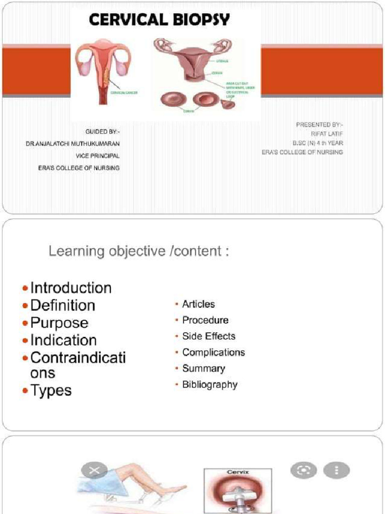 Cervical Biopsy | PDF