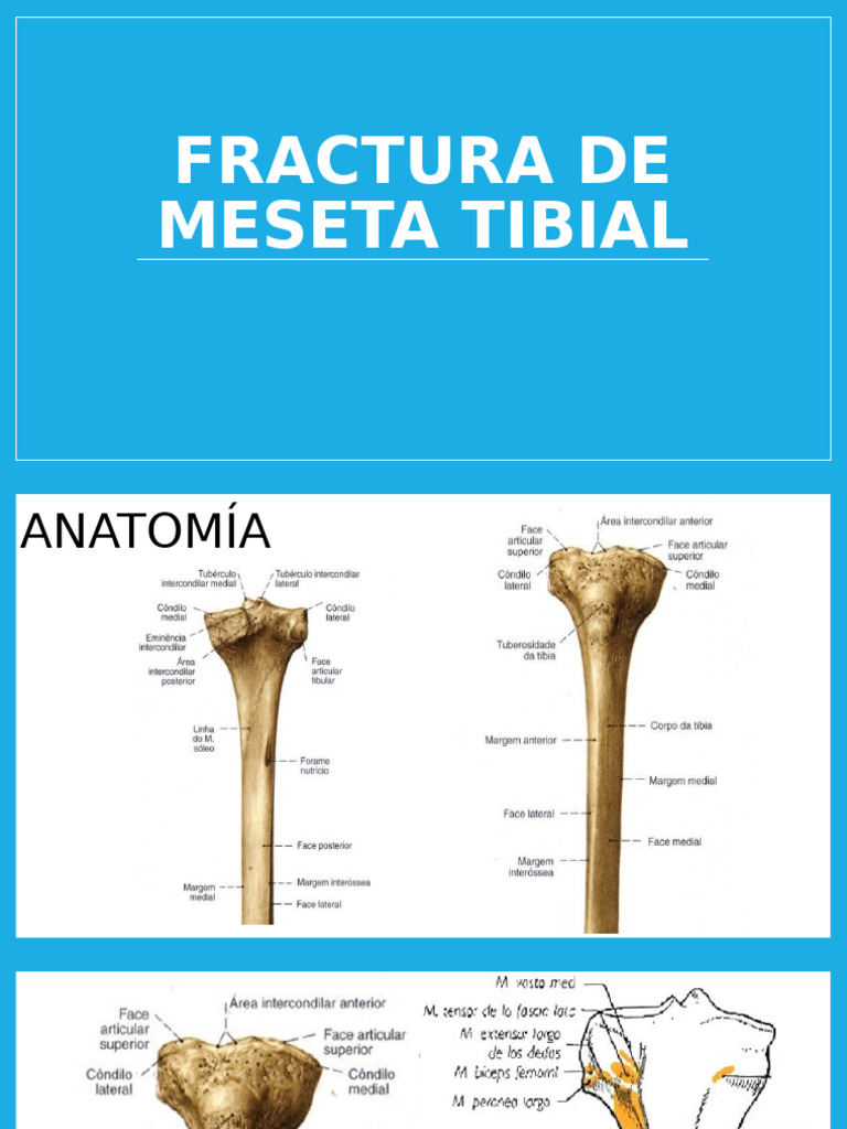fractura-de-meseta-tibial-pdf-rodilla-anatom-a-del-miembro-inferior