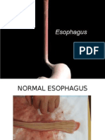 Esophagus