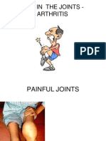 Joint Pains Agaram