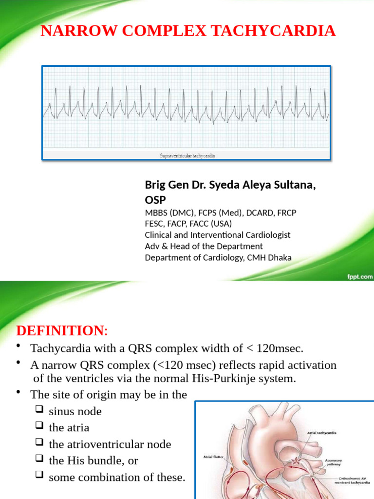 Ecg-Narrow Complex Tach | PDF | Electrocardiography | Heart