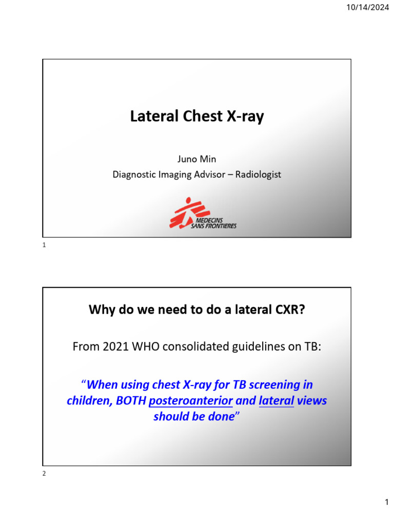 Normal Lateral Chest X-ray Overview | PDF | Thorax | Lung