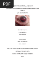 Download Referat Trauma Tumpul Pada Mata by Anggri Septyan SN89606680 doc pdf