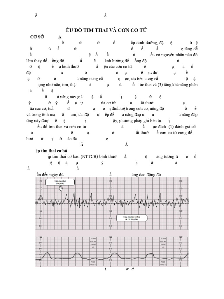 Biểu Đồ Tim Thai Và Cơn Co Tử Cung - Thanh Hoài | PDF