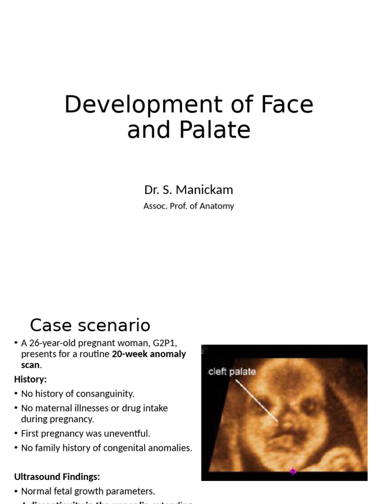 Face and Palate Development Overview | PDF | Human Nose | Lip
