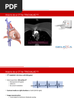 CT Venogram Protocol Overview | PDF | Ct Scan | Medical Imaging