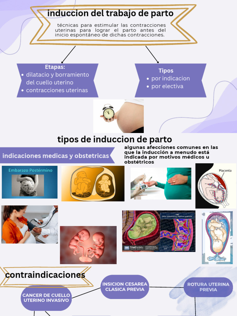 Inducción del Parto: Técnicas y Consideraciones | PDF | Parto ...