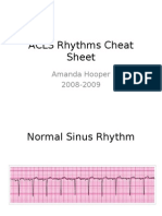 ACLS Rhythms Cheat Sheet