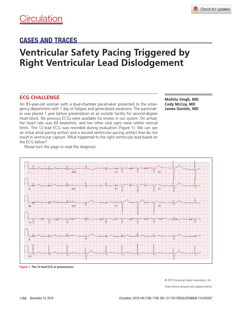 Singh Et Al Ventricular Safety Pacing Triggered by Right Ventricular ...