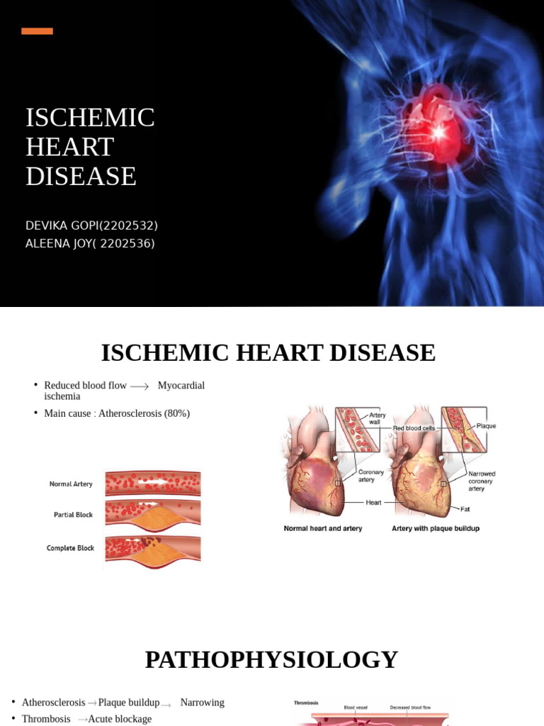 Ischemic Heart Disease Overview | PDF