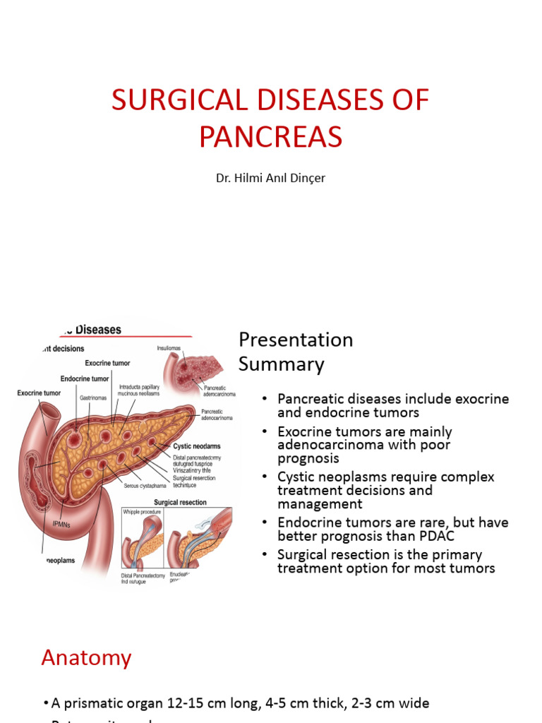 Surgical Diseases of the Pancreas Overview | PDF | Pancreatic Cancer ...
