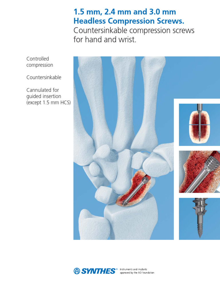 Synthes Headless Compression Screws | PDF | Screw | Hand