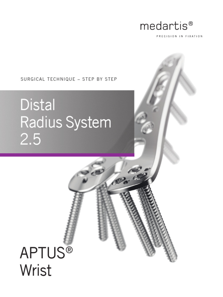 Medartis APTUS Distal Radius Guide | PDF | Drill | Limbs (Anatomy)