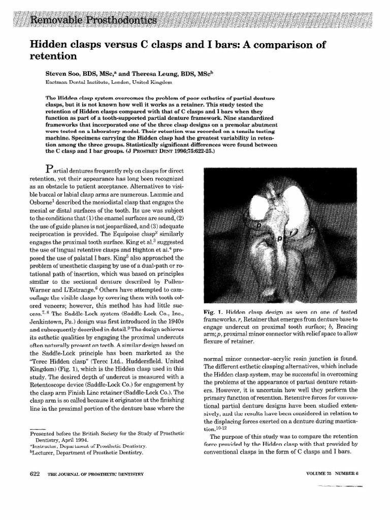I-Bar vs C Clasp Retention Study | PDF | Dentures | Dentistry Branches