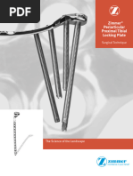 T2 Tibial Nailing System | PDF | Knee | Screw