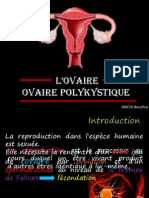 ovaire polykystique