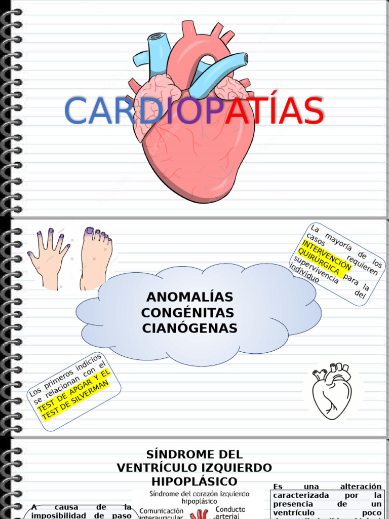Guia de Cardiopatías | PDF | Trombo | Ventrículo (corazón)