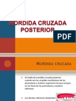 Mordida Cruzada Posterior