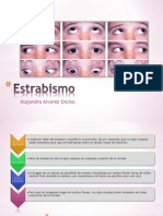 Estrabismo