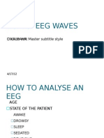 Normal Eeg Waves