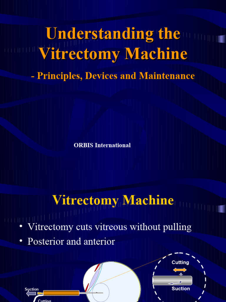 Vitrectomy Machine: Principles & Maintenance | PDF