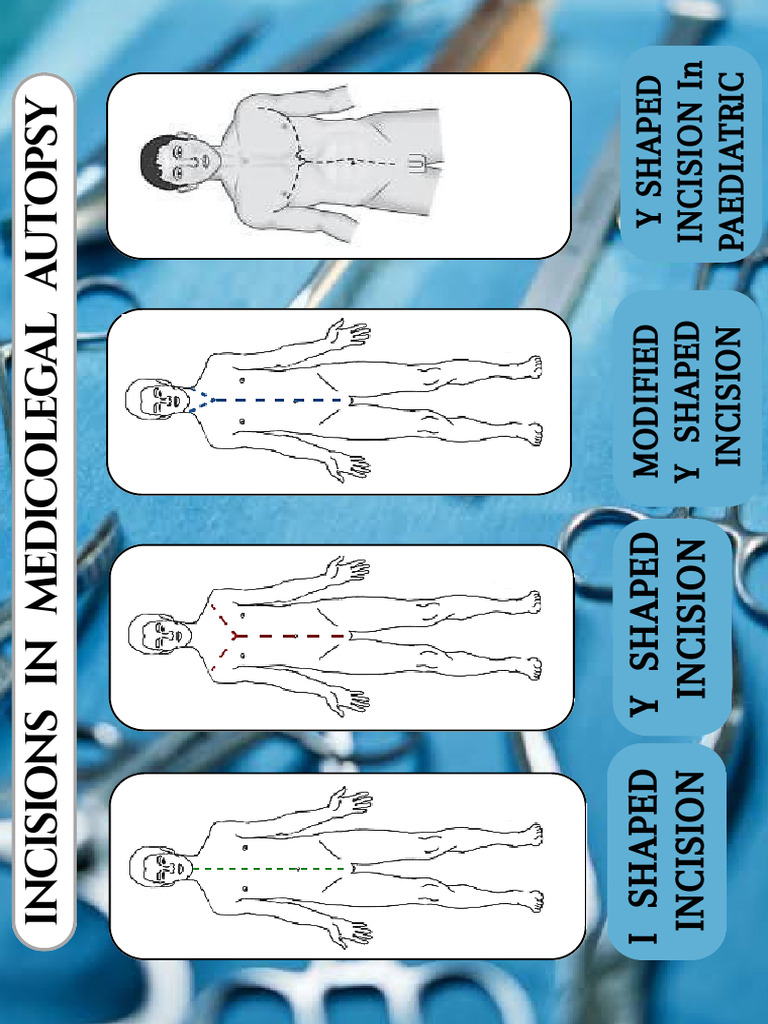 Incisions in Medicolegal Autopsy 20250613 115027 0000 | PDF