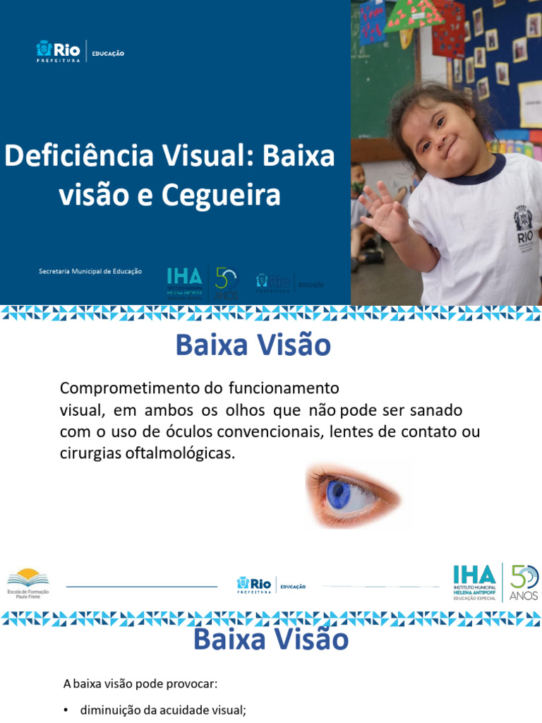 5 - 4.4 Deficiência Visual - Baixa Visão e Cegueira | PDF | Deficiência ...