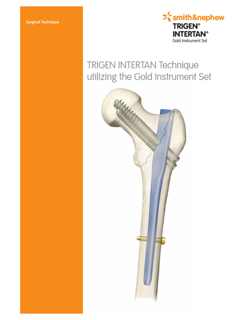 TRIGEN INTERTAN Surgical Technique Guide | PDF | Screw | Drill