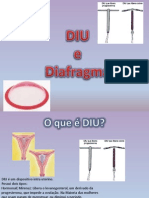 DIU e Diafragma