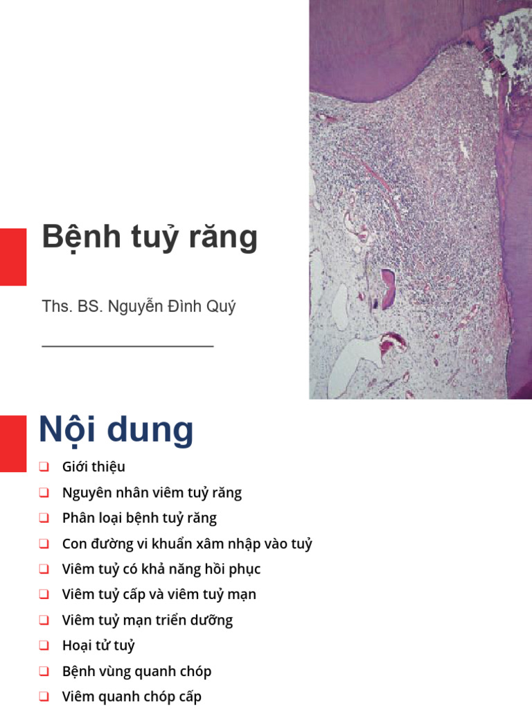 Y5 - Viem Tuy Rang | PDF