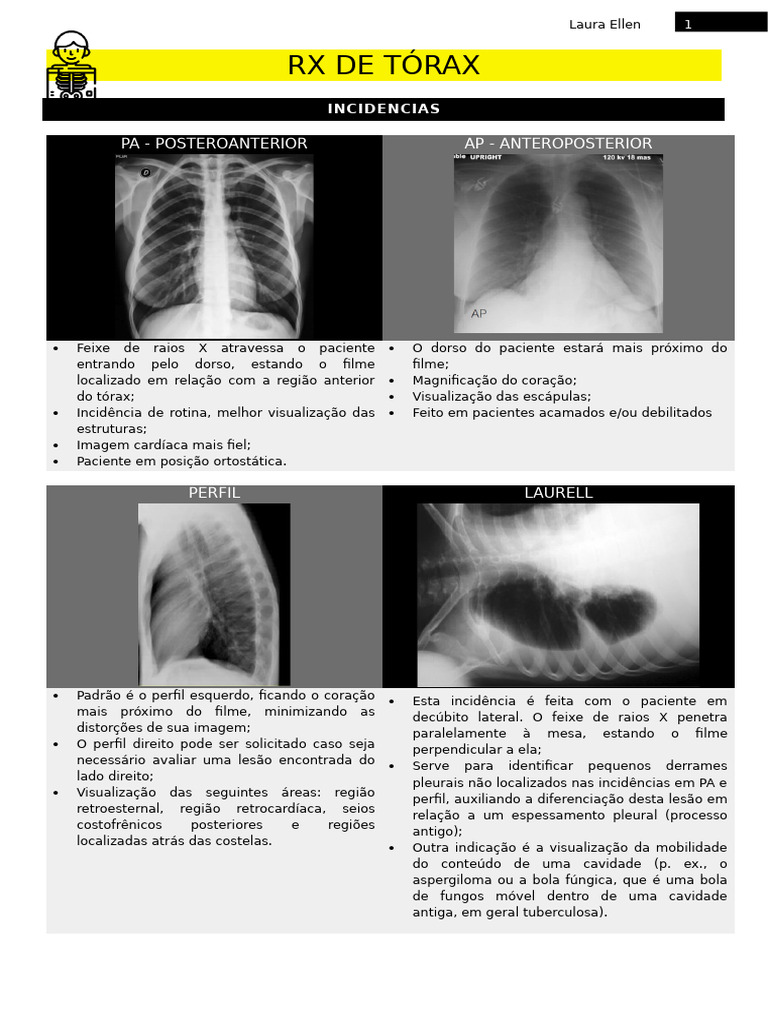 Análise e Interpretação de RX de Tórax | PDF | Pulmão | Coração