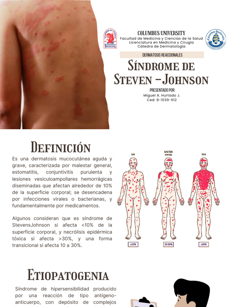 13.sindrome de Steven Jhonson | PDF | Condiciones cutáneas | Medicina
