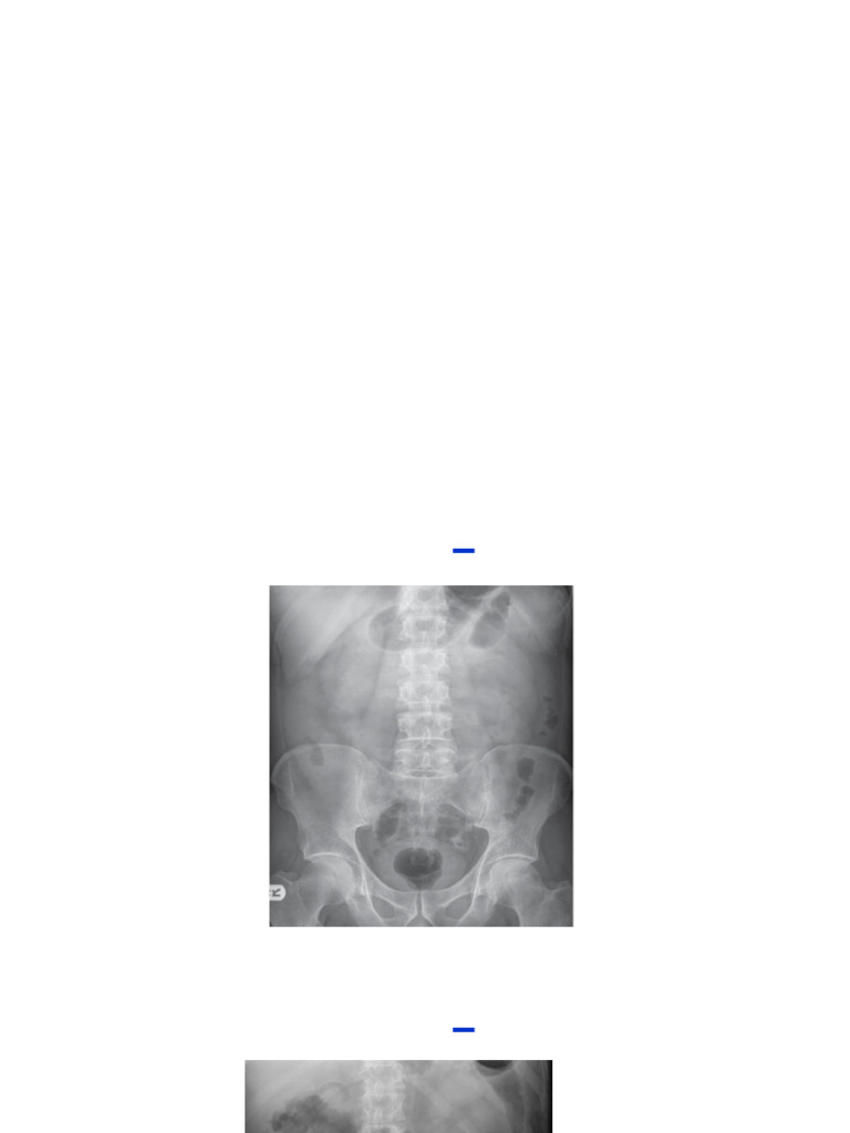 Applying ABCDE to Abdominal Radiographs | PDF