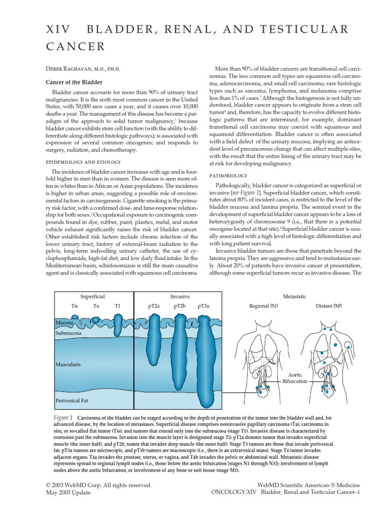 Bladder Cancer Overview and Management | PDF | Metastasis | Cancer