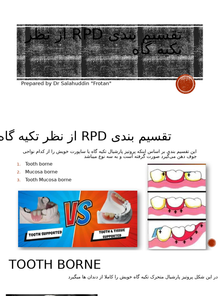 RPD Classification | PDF