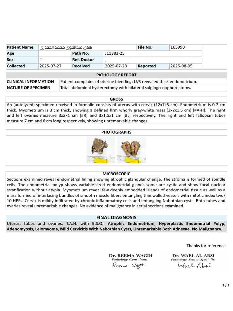 Hysterectomy Pathology Findings | PDF | Uterus | Mammal Female ...