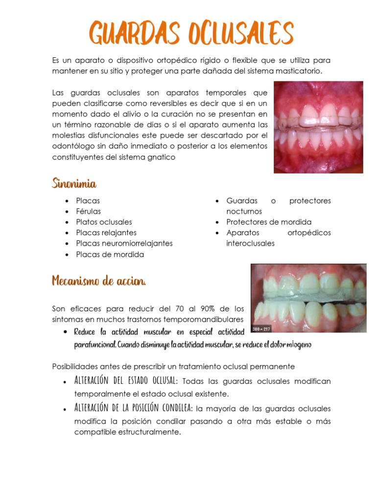 Guardas oclusales: Funciones y beneficios | PDF | Especialidades ...