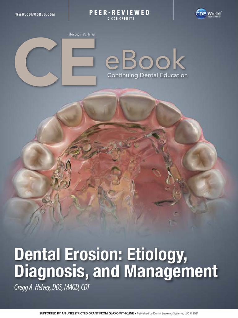 Dental Erosion Etiology Diagnosis and Management | PDF | Human Tooth ...
