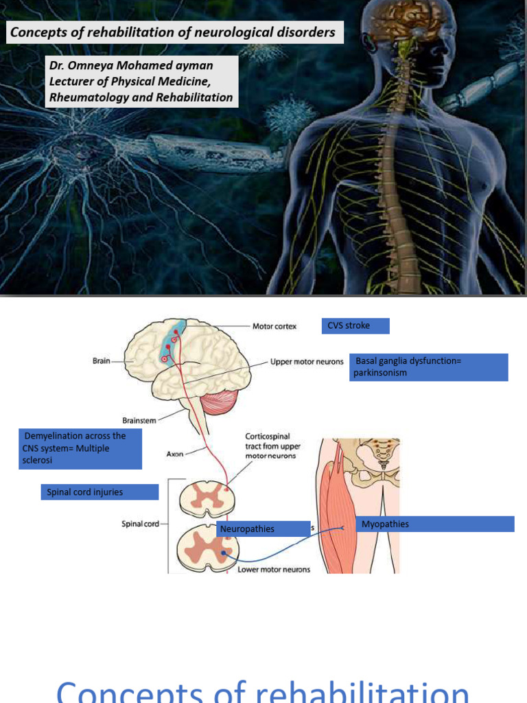 Rehabilitation Strategies for Neurological Disorders | PDF | Balance ...