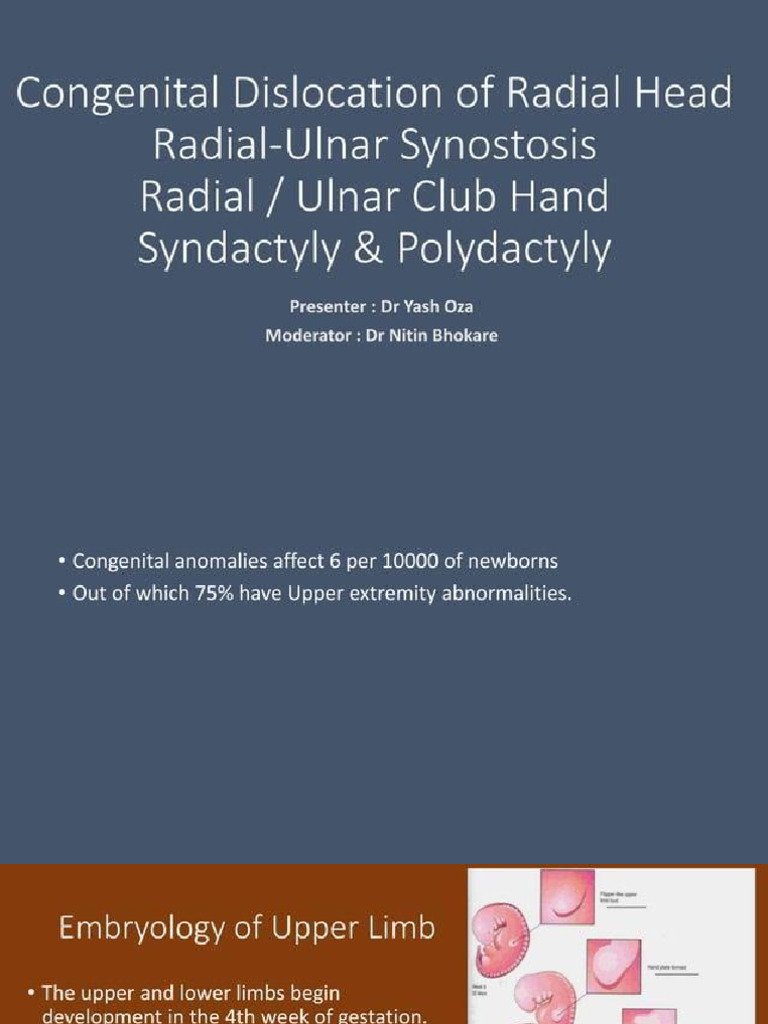 Congenital Anomalie of Upper Limb | PDF
