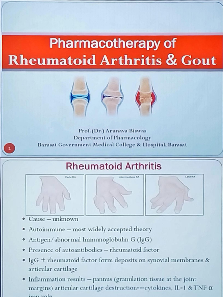 Rheumatoid Arthritis | PDF