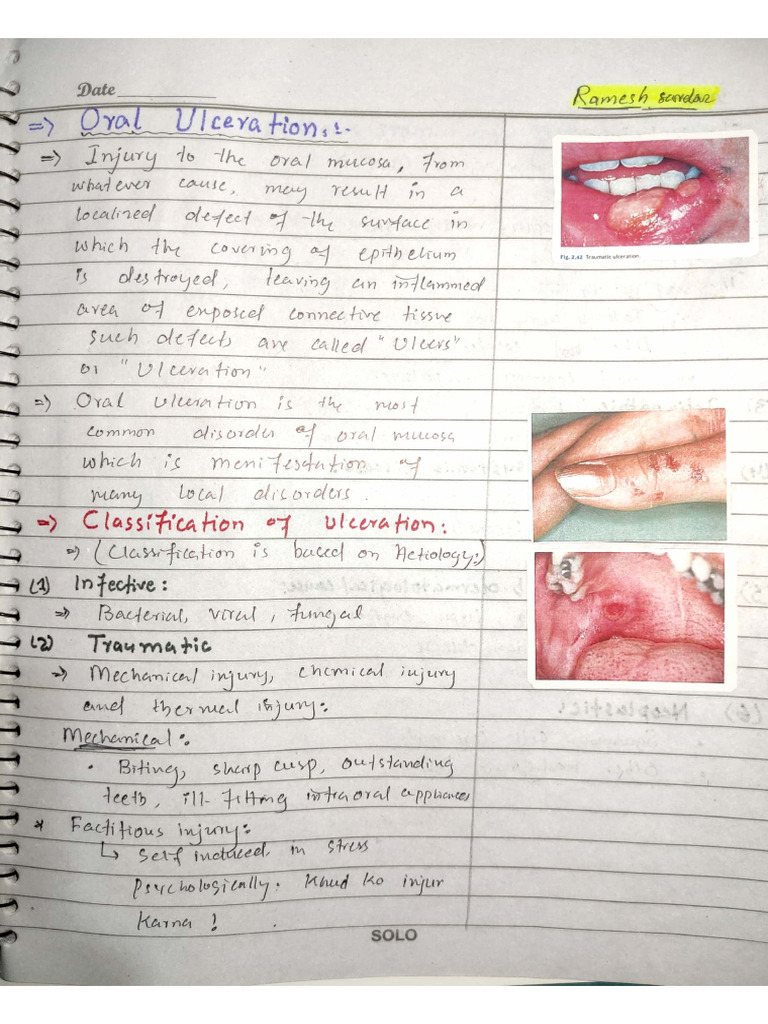 Oral Ulcers | PDF