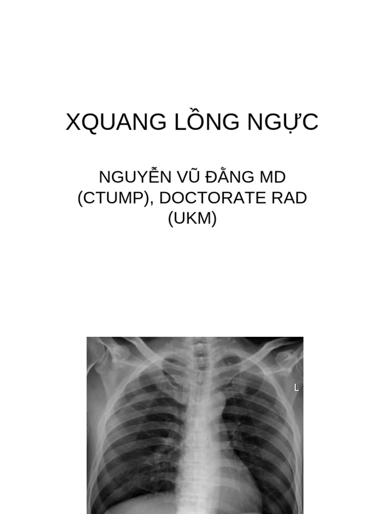 Undergrad Xquang L NG NG C | PDF