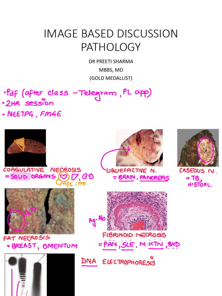 Durck Granuloma Overview | PDF | Anatomy | Medical Specialties