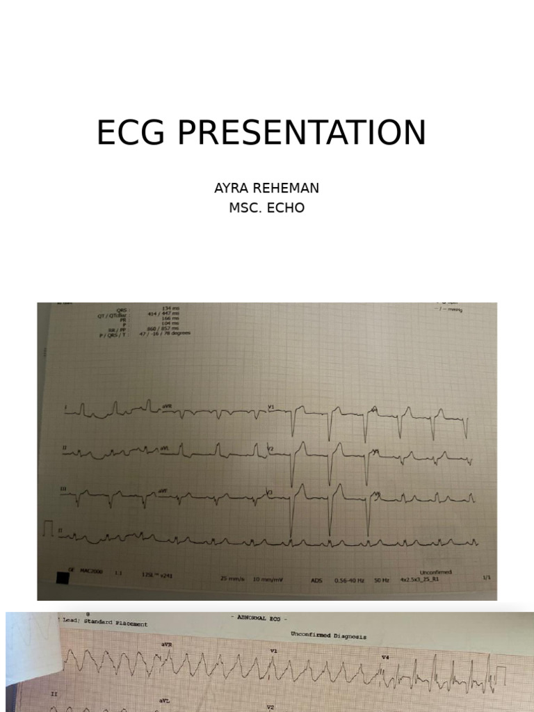 Ecg Presentation Pdf