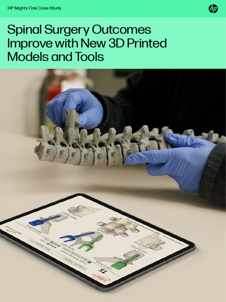 3D Printed Solutions for Spine Surgery | PDF | 3 D Printing