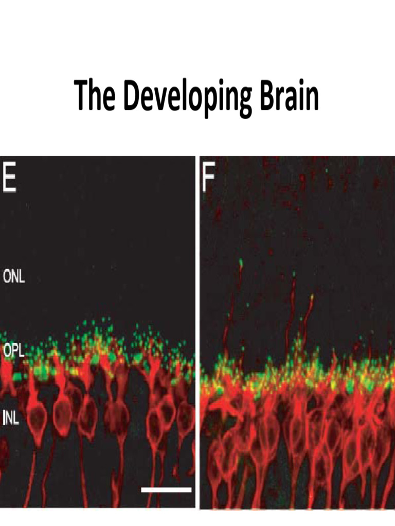 Understanding Vertebrate Brain Development | PDF | Nervous System | Brain
