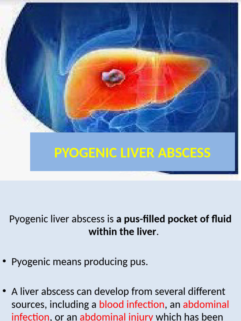 Pyogenicliverabscess 221212045501 61f0e0a0 | PDF | Liver | Medical ...